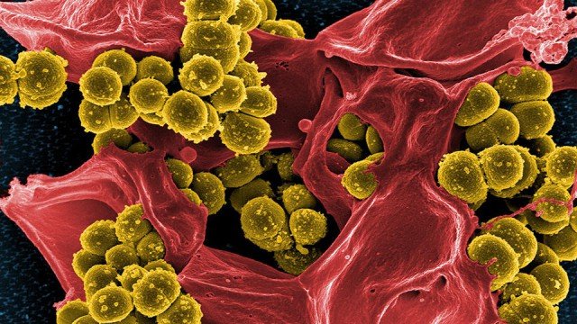 Umgang mit der MRSA-Infek­tion