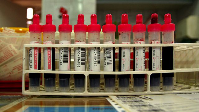 DDG fordert Verbot ungeeig­ne­ter Blutent­nah­me­sys­teme