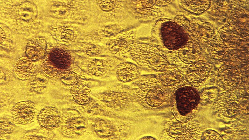 Chlamydia trachomatis.