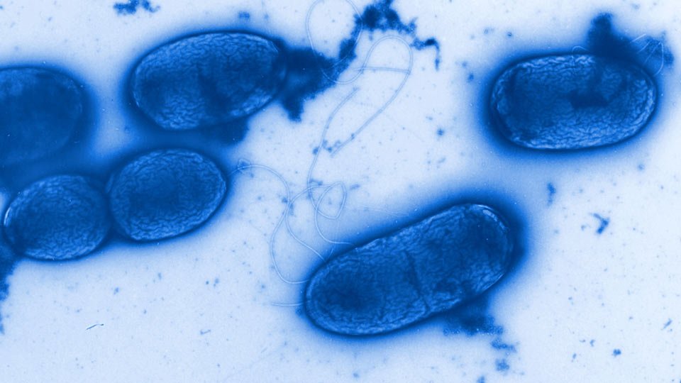 Pseudomonas-Infektionen sind bisher nur schwer behandelbar. Mittels eines neuartigen Models und einer Antibiotika-Kombination konnten HZI-Forscher nun Fortschritte in der Therapie erzielen.