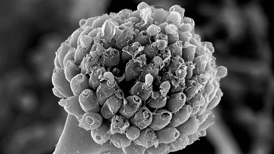 Aspergillus