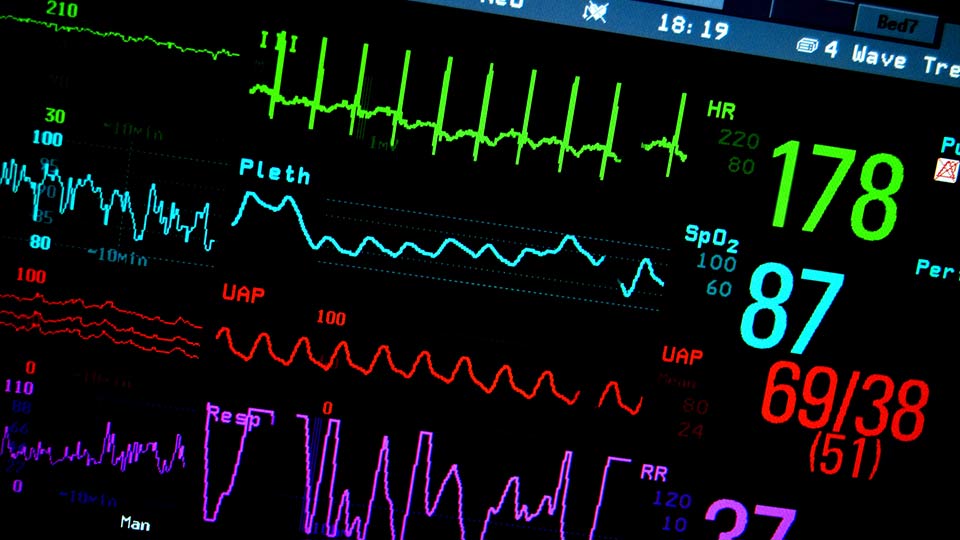 Monitoring Herzstillstand
