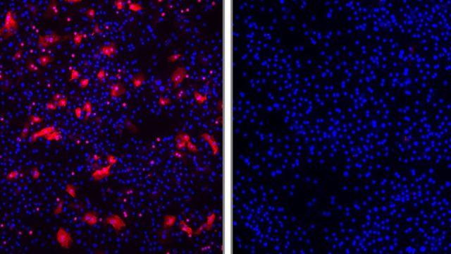 Forscher entwi­ckeln neuar­ti­ges Arznei­mit­tel gegen Hepati­tis B und D