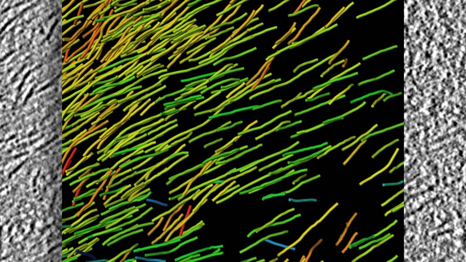 Proteinaggregate, die toxisch auf Zellen wirken.