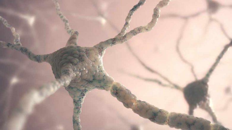 Bei einem epileptischen Anfall feuern unkontrolliert Neuronengruppen im Gehirn.