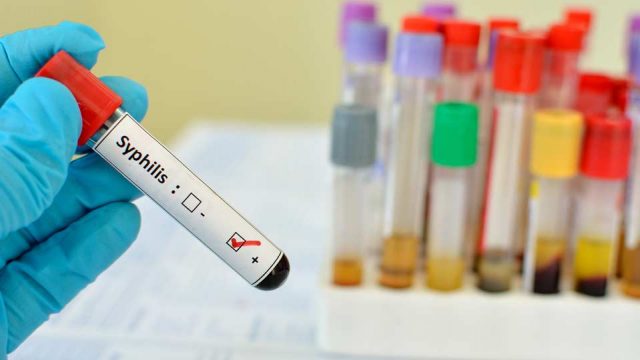 Epide­mio­lo­gen besorgt: Syphi­lis breitet sich weiter aus