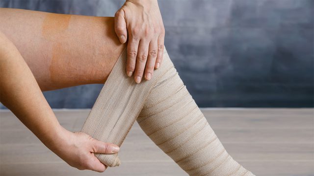 Ohne Kompres­sion kein Thera­pie­er­folg