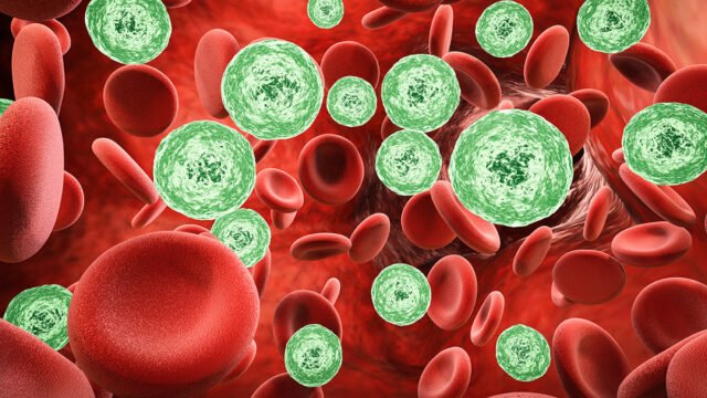 „Deutsch­land erkennt Sepsis“ – neue Aufklä­rungs­kam­pa­gne beginnt