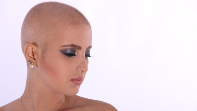 Dauer­haf­ter Haarver­lust nach Chemo­the­ra­pie: Schmer­zens­geld!