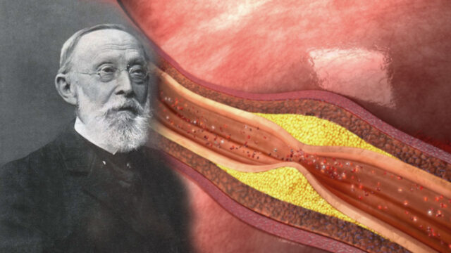 5 Fakten zu Rudolf Virchow