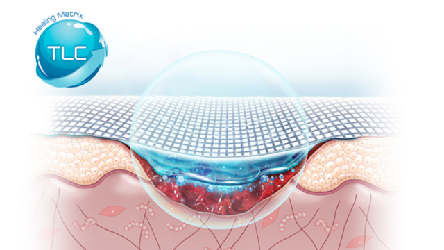 Von der Fritteuse zur weltwei­ten Innova­tion: Die Erfolgs­ge­schichte der Lipido­kol­loid-Techno­lo­gie (TLC)